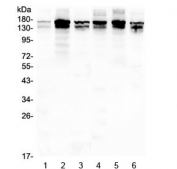 Western blot testing of rat 1) lung, 2) ovary, 3) brain and mouse 4) lung, 5) ovary and 6) brain lysate with SHIP2 antibody at 0.5ug/ml. Predicted molecular weight ~139 kDa (isoform 1), ~113 kDa (isoform 2).