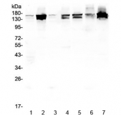Western blot testing of human 1) placenta, 2) HeLa, 3) U-2 OS, 4) PC-3, 5) Caco-2, 6) A549 and 7) K562 lysate with SHIP2 antibody at 0.5ug/ml. Predicted molecular weight ~139 kDa (isoform 1), ~113 kDa (isoform 2).