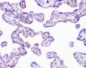 IHC staining of FFPE human placenta with SHIP2 antibody at 1ug/ml. HIER: boil tissue sections in pH6, 10mM citrate buffer, for 10-20 min followed by cooling at RT for 20 min.
