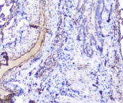 IHC staining of FFPE rat lung with SHIP2 antibody at 1ug/ml. HIER: boil tissue sections in pH6, 10mM citrate buffer, for 10-20 min followed by cooling at RT for 20 min.