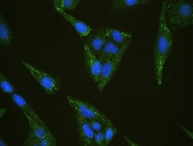 IF/ICC staining of FFPE human U-2 OS cells with SHIP2 antibody (green) at 2ug/ml and DAPI nuclear stain (blue). HIER: steam section in pH6 citrate buffer for 20 min.