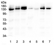 Western blot testing of human 1) A549, 2) PC-3, 3) A431, 4) placenta, 5) SHG-44, 6) U-2 OS and 7) HeLa lysate with ITGA3 antibody at 0.5ug/ml. Expected molecular weight: 119-150 kDa depending on glycosylation level.