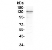 Western blot testing of mouse HEPA1-6 lysate with ITGA3 antibody at 0.5ug/ml. Expected molecular weight: 119-150 kDa depending on glycosylation level.