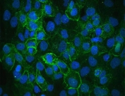 IF/ICC staining of FFPE human A431 cells with ITGA3 antibody (green) at 2ug/ml and DAPI nuclear stain (blue). HIER: steam section in pH6 citrate buffer for 20 min.