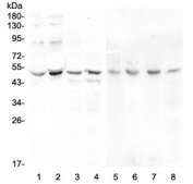 Western blot testing of human 1) Caco-2, 2) PC-3, 3) A549, 4) HeLa, 5) rat stomach, 6) rat testis, 7) mouse testis and 8) mouse liver lysate with KCNN4 antibody at 0.5ug/ml. Predicted molecular weight ~48 kDa.