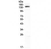 Western blot testing of human K562 cell lysate with LATS1 antibody at 0.5ug/ml. Expected molecular weight: 127-150 kDa.
