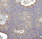 IHC staining of FFPE human spleen tissue with LMAN1 antibody. HIER: boil tissue sections in pH8 EDTA buffer, for 10-20 min followed by cooling at RT for 20 min.