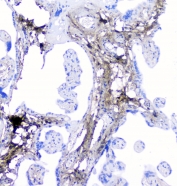 IHC staining of FFPE human placenta with LUM antibody at 1ug/ml. HIER: boil tissue sections in pH6, 10mM citrate buffer, for 10-20 min followed by cooling at RT for 20 min.