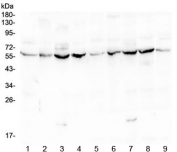 Western blot testing of mouse 1) liver, 2) ovary, 3) testis, 4) lung and rat 5) liver, 6) ovary, 7) testis, 8) lung and 9) heart lysate with LUM antibody at 0.5ug/ml. Expected moleculer weight: ~40 kDa (unmodified), ~60 kDa (glycosylated).