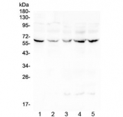 Western blot testing of human 1) placenta, 2) Caco-2, 3) CCRF-CEM, 4) HeLa and 5) Jurkat lysate with LUM antibody at 0.5ug/ml. Expected moleculer weight: ~40 kDa (unmodified), ~60 kDa (glycosylated).
