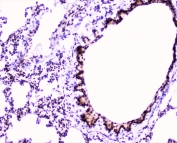 IHC staining of FFPE rat lung with MEF2C antibody at 2ug/ml. HIER: boil tissue sections in pH6, 10mM citrate buffer, for 10-20 min followed by cooling at RT for 20 min.