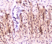 IHC staining of FFPE rat heart with MEF2C antibody at 2ug/ml. HIER: boil tissue sections in pH6, 10mM citrate buffer, for 10-20 min followed by cooling at RT for 20 min.