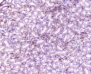 IHC staining of FFPE rat kidney with MEF2C antibody at 2ug/ml. HIER: boil tissue sections in pH6, 10mM citrate buffer, for 10-20 min followed by cooling at RT for 20 min.