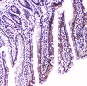 IHC staining of FFPE rat small intestine with MEF2C antibody at 2ug/ml. HIER: boil tissue sections in pH6, 10mM citrate buffer, for 10-20 min followed by cooling at RT for 20 min.