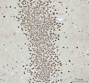 IHC staining of FFPE rat brain tissue with NOVA1 antibody. HIER: boil tissue sections in pH8 EDTA for 20 min and allow to cool before testing.