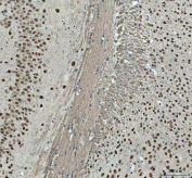 IHC staining of FFPE mouse brain tissue with NOVA1 antibody. HIER: boil tissue sections in pH8 EDTA for 20 min and allow to cool before testing.