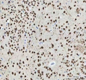 IHC staining of FFPE mouse brain tissue with NOVA1 antibody. HIER: boil tissue sections in pH8 EDTA for 20 min and allow to cool before testing.