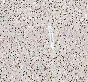 IHC staining of FFPE rat brain tissue with NOVA1 antibody. HIER: boil tissue sections in pH8 EDTA for 20 min and allow to cool before testing.