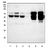 Western blot testing of 1) human PC-3, 2) human A549, 3) human U-87 MG, 4) human ThP-1, 5) rat brain and 6) mouse brain tissue lysate with NOVA1 antibody at 0.5ug/ml. Predicted molecular weight ~52 kDa.