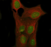 Immunofluorescent staining of FFPE human U-2 OS cells with NOVA1 antibody (green) and Beta Tubulin mAb (red). HIER: steam section in pH6 citrate buffer for 20 min.