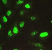 Immunofluorescent staining of FFPE human A549 cells with NOVA1 antibody. HIER: steam section in pH6 citrate buffer for 20 min.