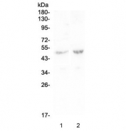 Western blot testing of human 1) Caco-2 and 2) SW620 lysate with PLA2G7 antibody at 0.5ug/ml. Expected molecular weight: 45-67 kDa depending on glycosylation level.