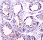 IHC staining of FFPE human testis with Doppel antibody at 1ug/ml. HIER: boil tissue sections in pH6, 10mM citrate buffer, for 10-20 min followed by cooling at RT for 20 min.