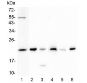 Western blot testing of 1) human SHG-44, 2) rat testis, 3) rat kidney, 4) mouse testis, 5) mouse kidney and 6) mouse brain lysate with Doppel antibody at 0.5ug/ml. Predicted molecular weight ~20 kDa.