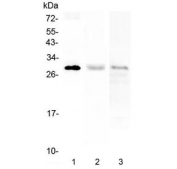 Western blot testing of human 1) A375, 2) HL60 and 3) CCRM-CEM cell lysate with PTCRA antibody at 0.5ug/ml. Predicted molecular weight ~29 kDa.