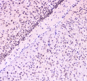 IHC staining of FFPE mouse brain with RAD51 antibody at 1ug/ml. HIER: boil tissue sections in pH6, 10mM citrate buffer, for 10-20 min followed by cooling at RT for 20 min.