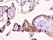 IHC staining of FFPE human placenta with RAD51 antibody at 1ug/ml. HIER: boil tissue sections in pH6, 10mM citrate buffer, for 10-20 min followed by cooling at RT for 20 min.