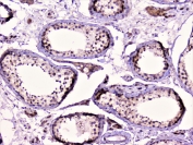 IHC staining of FFPE human testis with RAD51 antibody at 1ug/ml. HIER: boil tissue sections in pH6, 10mM citrate buffer, for 10-20 min followed by cooling at RT for 20 min.
