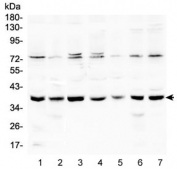 Western blot testing of human 1) HeLa, 2) A431, 3) 293T, 4) K562, 5) Jurkat, 6) A549 and 7) Caco-2 lysate with RAD51 antibody at 0.5ug/ml. Predicted molecular weight ~37 kDa.
