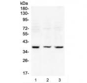 Western blot testing of 1) rat testis, 2) mouse testis and 3) mouse thymus lysate with RAD51 antibody at 0.5ug/ml. Predicted molecular weight ~37 kDa.
