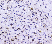 IHC staining of FFPE rat brain with RAD51 antibody at 1ug/ml. HIER: boil tissue sections in pH6, 10mM citrate buffer, for 10-20 min followed by cooling at RT for 20 min.