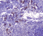 IHC staining of FFPE mouse spleen with RASAL1 antibody at 1ug/ml. HIER: boil tissue sections in pH6, 10mM citrate buffer, for 10-20 min followed by cooling at RT for 20 min.