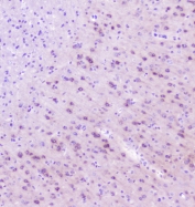 IHC staining of FFPE mouse brain with RASAL1 antibody at 1ug/ml. HIER: boil tissue sections in pH6, 10mM citrate buffer, for 10-20 min followed by cooling at RT for 20 min.