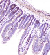 IHC staining of FFPE mouse intestine with RASAL1 antibody at 1ug/ml. HIER: boil tissue sections in pH6, 10mM citrate buffer, for 10-20 min followed by cooling at RT for 20 min.