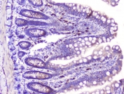 IHC staining of FFPE rat intestine with RASAL1 antibody at 1ug/ml. HIER: boil tissue sections in pH6, 10mM citrate buffer, for 10-20 min followed by cooling at RT for 20 min.