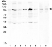 Western blot testing of human 1) placenta, 2) HeLa, 3) PC-3, 4) A431, 5) K562, 6) PANC-1, 7) rat testis and 8) mouse testis with RSK3 antibody at 0.5ug/ml. Expected molecular weight ~90 kDa.