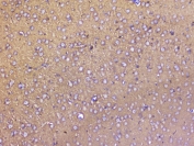 IHC staining of FFPE mouse brain with SNAP25 antibody at 2ug/ml. HIER: boil tissue sections in pH6, 10mM citrate buffer, for 10-20 min followed by cooling at RT for 20 min.