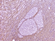 IHC staining of FFPE rat brain with SNAP25 antibody at 2ug/ml. HIER: boil tissue sections in pH6, 10mM citrate buffer, for 10-20 min followed by cooling at RT for 20 min.