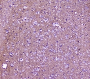 IHC staining of FFPE rat brain with SNAP25 antibody at 2ug/ml. HIER: boil tissue sections in pH6, 10mM citrate buffer, for 10-20 min followed by cooling at RT for 20 min.