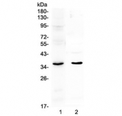 Western blot testing of 1) rat lung and 2) mouse lung lysate with SPARC antibody at 0.5ug/ml. Expected molecular weight: 35-43 kDa depending on glycosylation level.