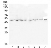 Western blot testing of 1) rat brain, 2) rat lung, 3) rat spleen, 4) rat kidney, 5) mouse brain, 6) mouse lung, 7) mouse spleen and 8) mouse kidney with TANK antibody at 0.5ug/ml. Expected molecular weight ~48 kDa.