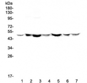 Western blot testing of human 1) HeLa, 2) placenta, 3) A549, 4) MDA-MB-453, 5) SW620, 6) 22RV1 and 7) SW579 with TANK antibody at 0.5ug/ml. Expected molecular weight ~48 kDa.