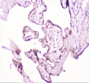 IHC staining of FFPE human placenta with TANK antibody at 1ug/ml. HIER: boil tissue sections in pH6, 10mM citrate buffer, for 10-20 min followed by cooling at RT for 20 min.