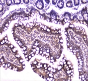 IHC staining of FFPE rat small intestine with TANK antibody at 1ug/ml. HIER: boil tissue sections in pH6, 10mM citrate buffer, for 10-20 min followed by cooling at RT for 20 min.