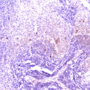 IHC staining of FFPE rat spleen with TANK antibody at 1ug/ml. HIER: boil tissue sections in pH6, 10mM citrate buffer, for 10-20 min followed by cooling at RT for 20 min.