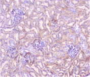 IHC staining of FFPE mouse kidney with TNF Receptor antibody at 1ug/ml. HIER: boil tissue sections in pH6, 10mM citrate buffer, for 10-20 min followed by cooling at RT for 20 min.